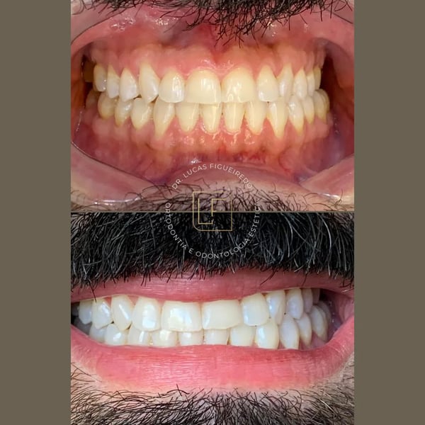 Caso tratado pelo Dr. Lucas Figueiredo — foto 6