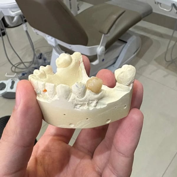 Caso tratado pelo Dr. Lucas Figueiredo — foto 7