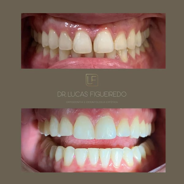Caso tratado pelo Dr. Lucas Figueiredo — foto 23