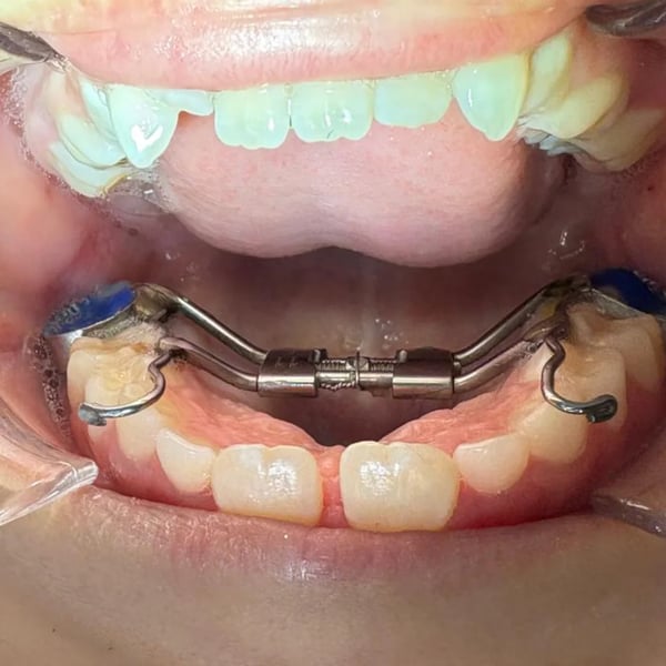 Caso tratado pelo Dr. Lucas Figueiredo — foto 11
