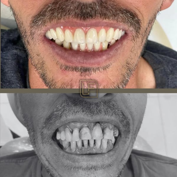 Caso tratado pelo Dr. Lucas Figueiredo — foto 10
