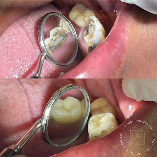 Caso tratado pelo Dr. Lucas Figueiredo — foto 12