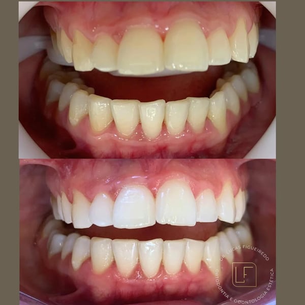 Caso tratado pelo Dr. Lucas Figueiredo — foto 22