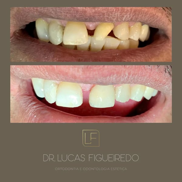 Caso tratado pelo Dr. Lucas Figueiredo — foto 17