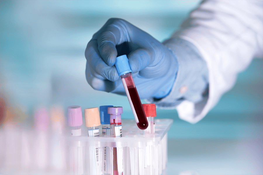 Profissional de laboratório segurando amostra de sangue em ambiente de hemoterapia