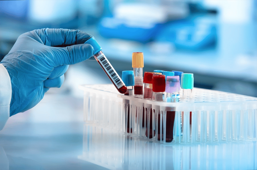 Profissional de saúde manuseando tubos de coleta de sangue em ambiente de hemoterapia