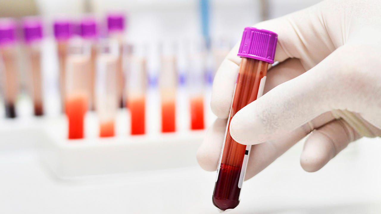 Laboratório de hemoterapia, com processamento de amostras e bolsas de sangue