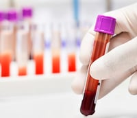 Laboratório de hemoterapia com processamento de amostras e bolsas de sangue