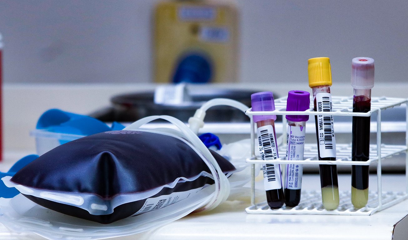 Estrutura de hemocentro com materiais e bolsas de sangue, ambiente típico de serviços de hematologia e hemoterapia.