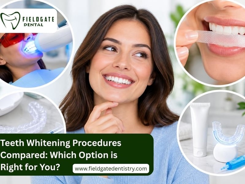 Right for You, in the image a girl is smiling Teeth Whitening Procedures Compared: Which Option Is Right for You? – A smiling woman showing her bright, white teeth, highlighting the results of different teeth whitening procedures for achieving a beautiful, confident smile.
