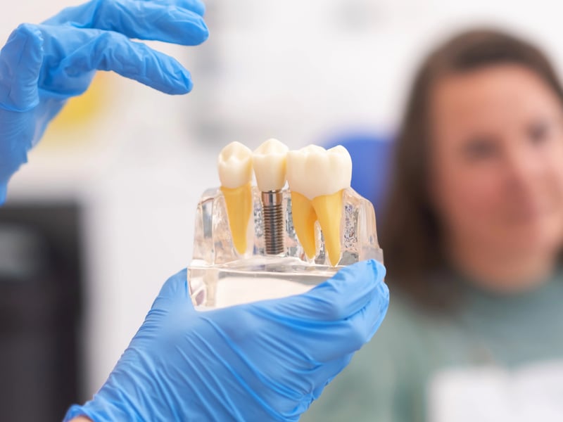 best dental implants mississauga