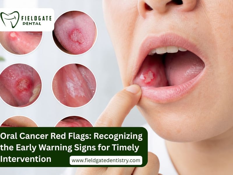 Oral Cancer Red Flags