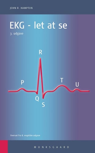 EKG - picture