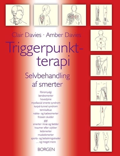 Triggerpunkt-terapi - picture