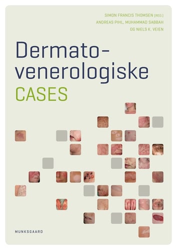 Dermato- venerologiske cases - picture