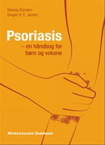Psoriasis_0