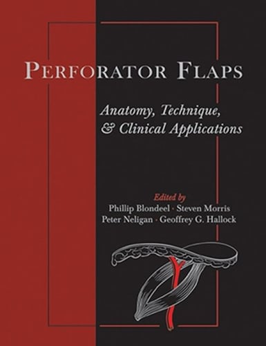 Perforator Flaps: Anatomy, Technique, & Clinical Applications, Second Edition_0