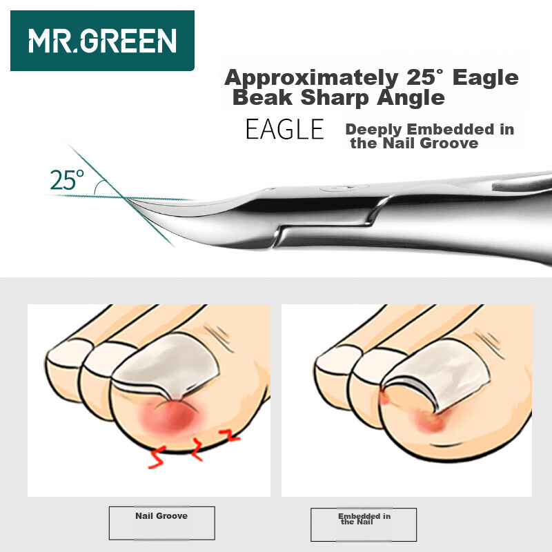 mr.green german ingrown nail clipper, precision tool