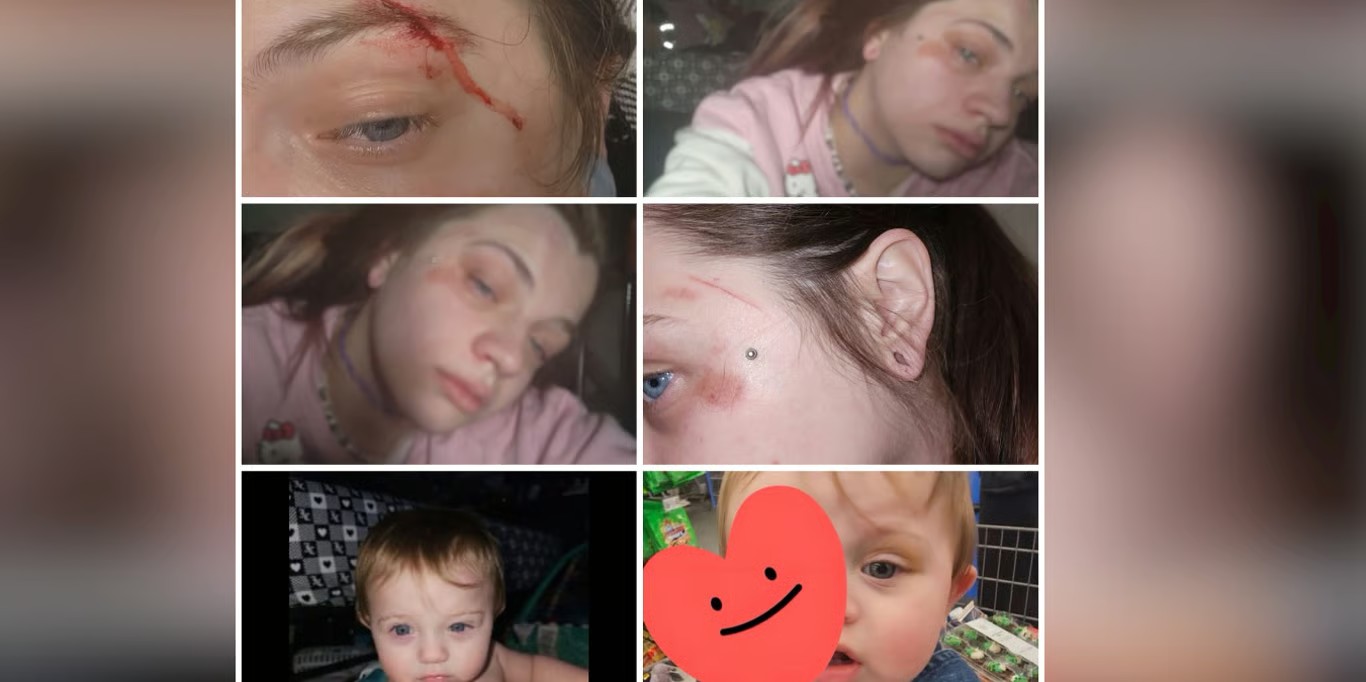 Survivor documenting her injuries
