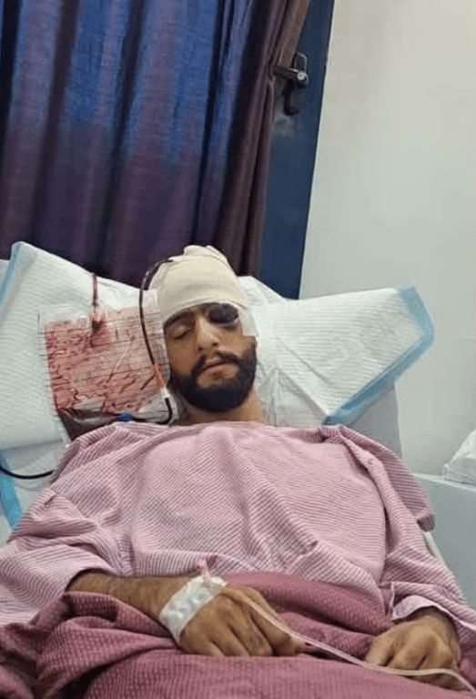 Injured man recovering in hospital