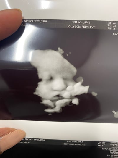 9EE2AAE3-E288-410E-9E73-D487DD381508