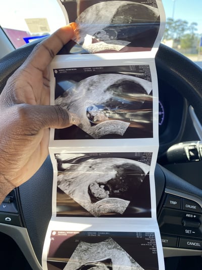 2436E4AE-BDF2-48E1-BC40-C3F8DC9EBA9E