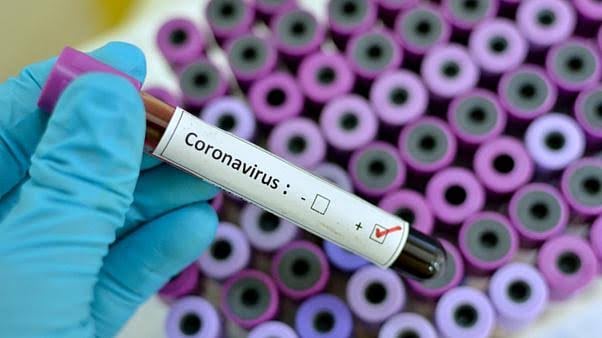 Gombe Yet To Receive COVID-19 Vaccine – Commissioner