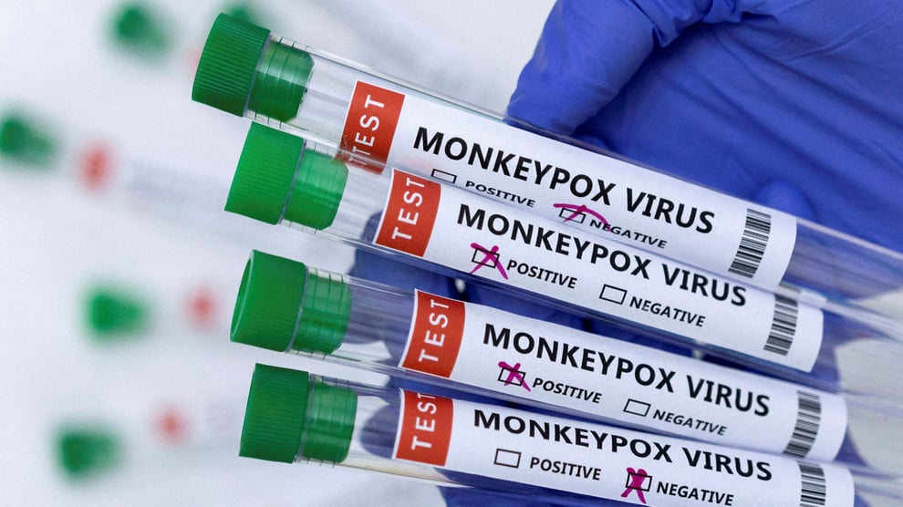 US To Add Additional 1.8 Million Doses To Monkeypox Vaccine 