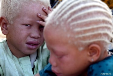 We're facing skin cancer – Albinism chairman to world lead