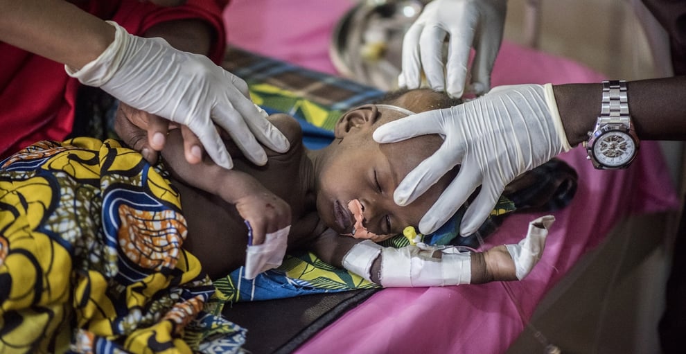 Cholera: DG Confirms Death Of Seven Children
