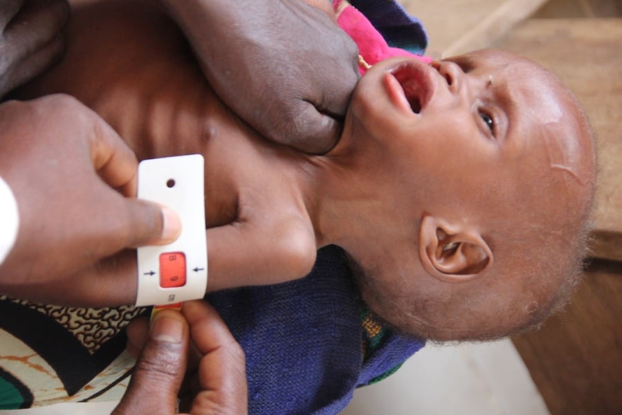 30,000 Malnourished Children To Get Treatment In Kaduna