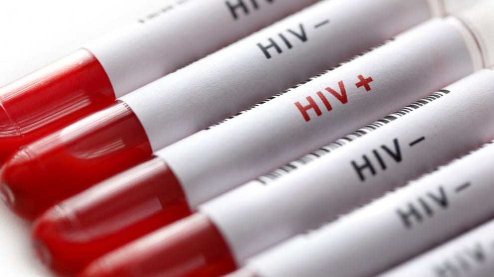 Ogun records over 46,000 living with HIV/AIDS — Commission