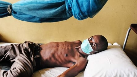 Tuberculosis: Target To End Global Epidemic Unmet — WHO