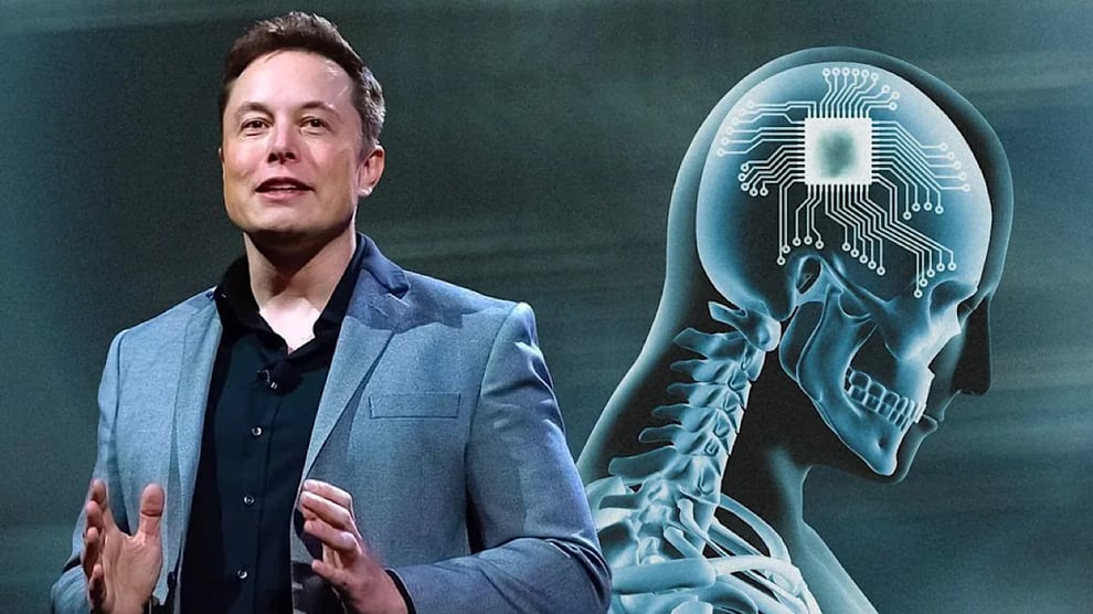 Human Brain Chips: Elon Musk's Neuralink Wins Approval 
