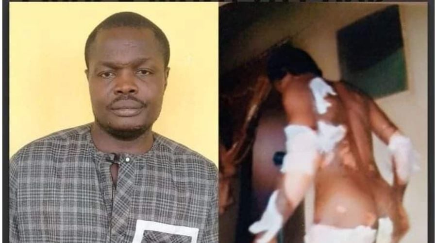Ogun Police Arrest Man For Setting Wife Ablaze