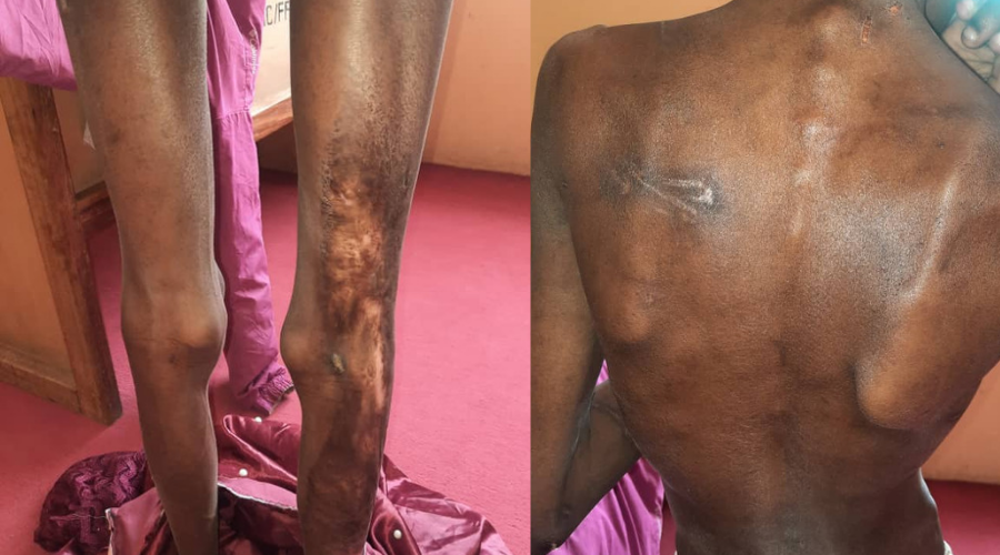  Brutalized Orphan Rescued From Aunt In Jos 