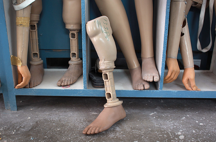 NGO Set To Give Out 100 Prosthetic Limbs To Children With Di