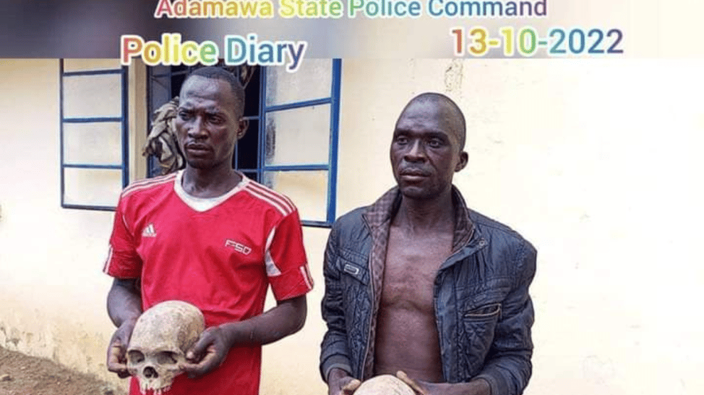 Adamawa Police Confirms Arrest of Two With Human Skulls