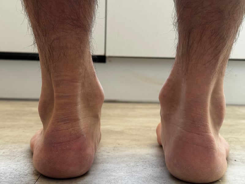 G8 Performance Pro Series 2620 Detailed Review And Additional Resources - Cycling Orthotics