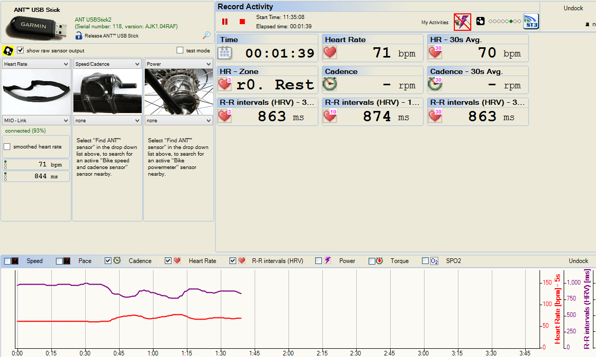 hrv R-R data from the MIO Link