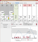 Garmin Acquires Firstbeat : Strava Next?