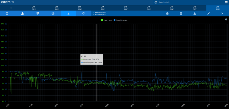 Apple Beddit Review - Beddit Sleep Monitor V3.5