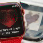 Apple Watch Series 7 ecg ekg