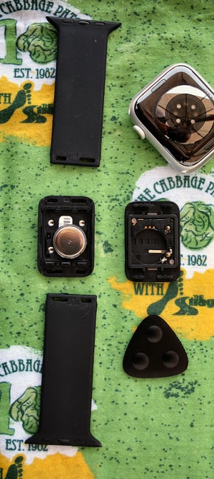 Aura strap 2 change battery or strap review