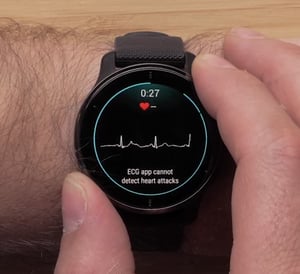 garmin Venu 2 plus ecg