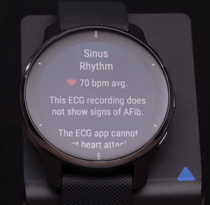 garmin Venu 2 plus ecg