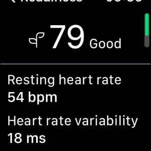 Important ! - Oura Ring Integrates With Apple Watch - Garmin To Follow?