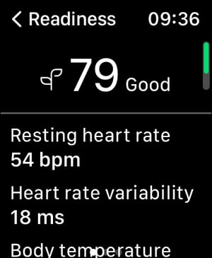 Important ! - Oura Ring Integrates With Apple Watch - Garmin To Follow?