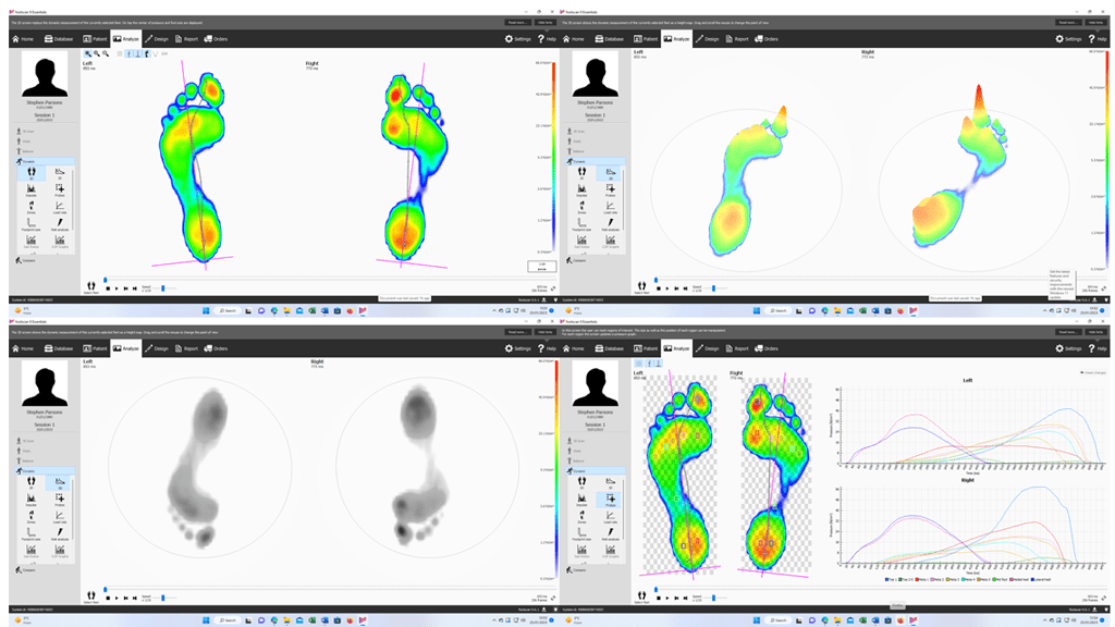 Marathon Orthotics - A Day Trip To Podo London