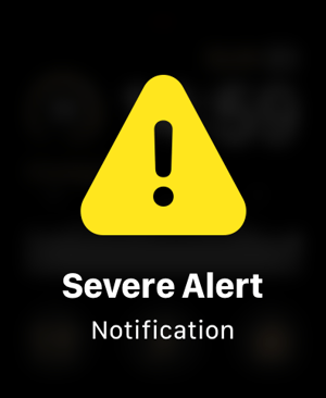 Apple Severe Alert